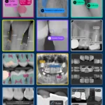 Pear AI Image Radiologic Capabilites